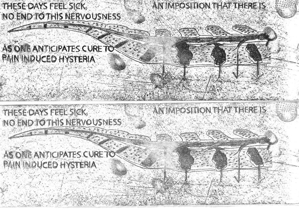 a black and white drawing that says in text 'these days feel sick, no end to this nervousness as one anticipates cure to pain induced hysteria, an imposition that there is' alongside a drawing of a spiney flat thing that mine by an insect or sea creature or fossil i'm not sure